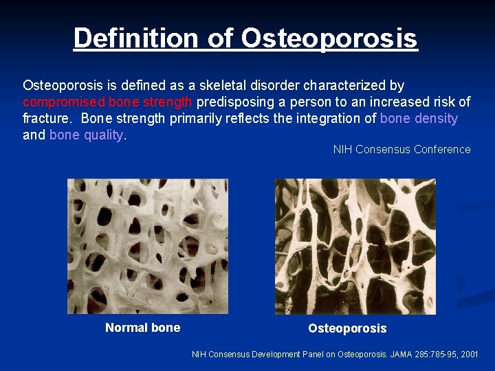 Definition of Osteoporosis is defined as a skeletal disorder characterized by compromised bone strength