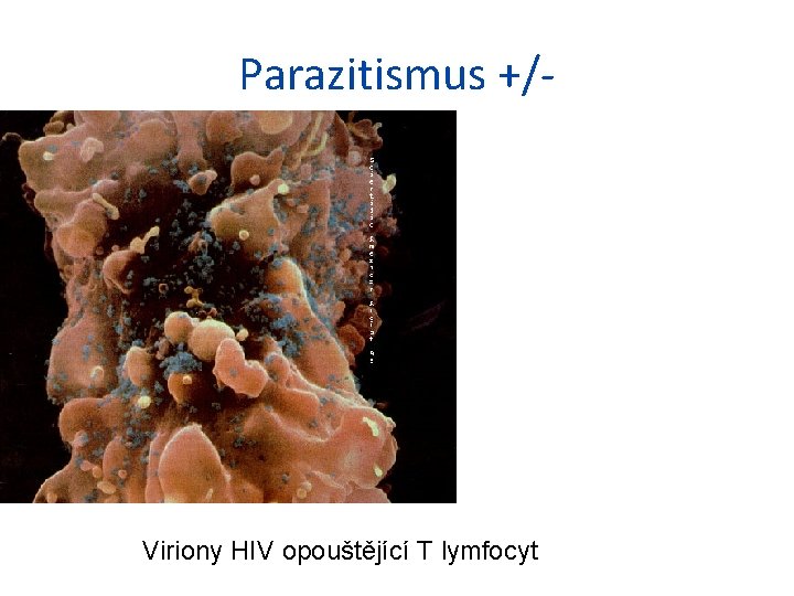 Parazitismus +/- Viriony HIV opouštějící T lymfocyt 