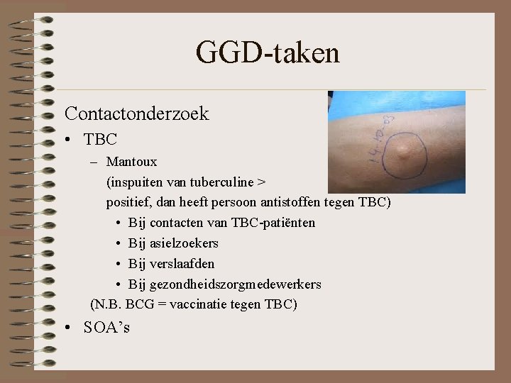 GGD-taken Contactonderzoek • TBC – Mantoux (inspuiten van tuberculine > positief, dan heeft persoon