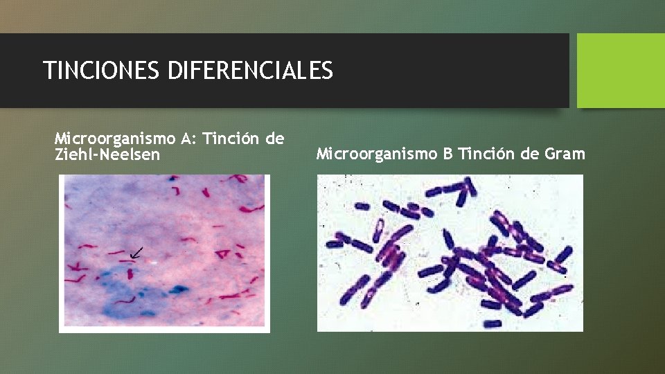 TINCIONES DIFERENCIALES Microorganismo A: Tinción de Ziehl-Neelsen Microorganismo B Tinción de Gram 