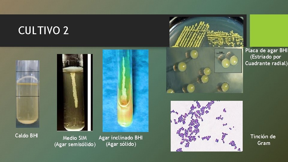 CULTIVO 2 Placa de agar BHI (Estriado por Cuadrante radial) Caldo BHI Agar inclinado