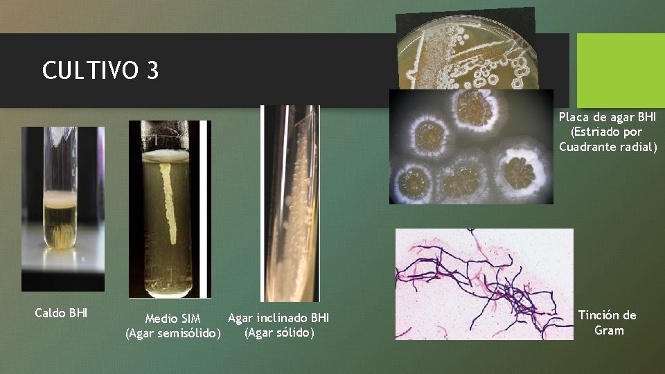 CULTIVO 3 Placa de agar BHI (Estriado por Cuadrante radial) Caldo BHI Agar inclinado
