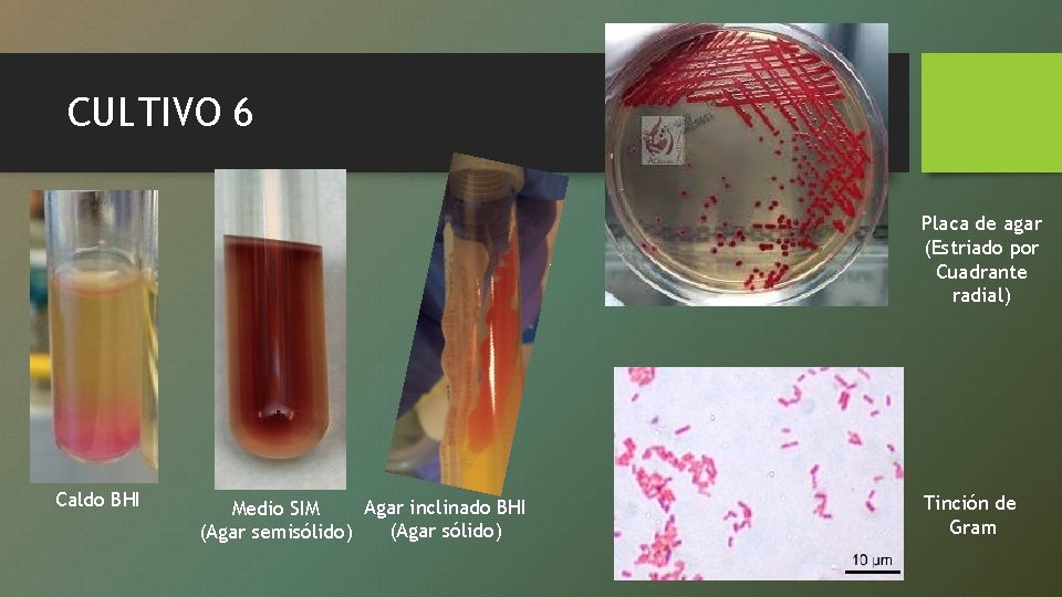 CULTIVO 6 Placa de agar (Estriado por Cuadrante radial) Caldo BHI Agar inclinado BHI