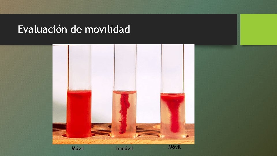 Evaluación de movilidad Móvil Inmóvil Móvil 