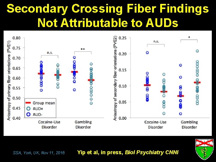 Secondary Crossing Fiber Findings Not Attributable to AUDs SSA, York, UK, Nov 11, 2016