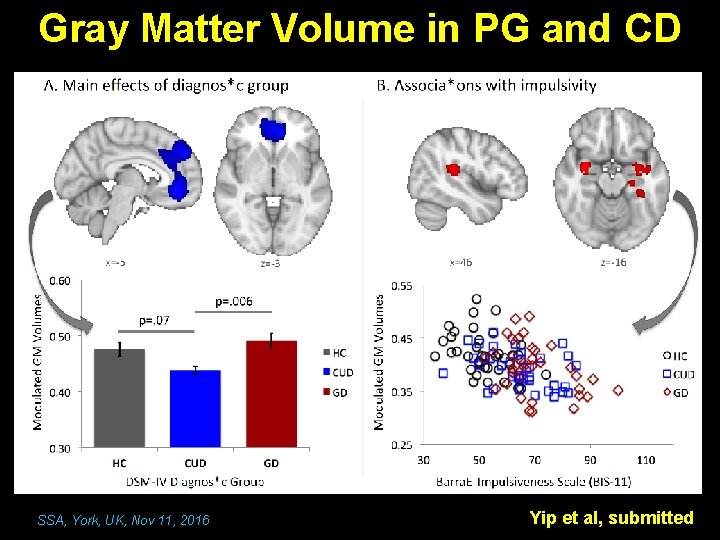 Gray Matter Volume in PG and CD SSA, York, UK, Nov 11, 2016 Yip