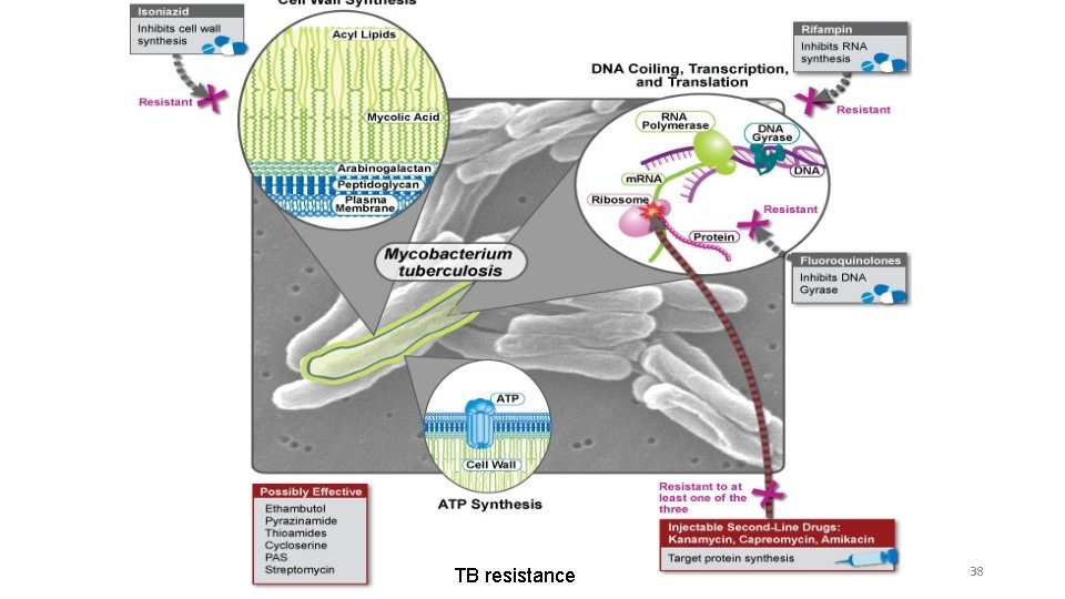 TB resistance 38 