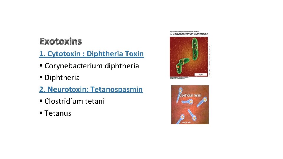 Exotoxins 1. Cytotoxin : Diphtheria Toxin § Corynebacterium diphtheria § Diphtheria 2. Neurotoxin: Tetanospasmin