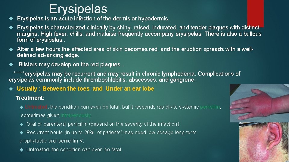 Erysipelas is an acute infection of the dermis or hypodermis. Erysipelas is characterized clinically