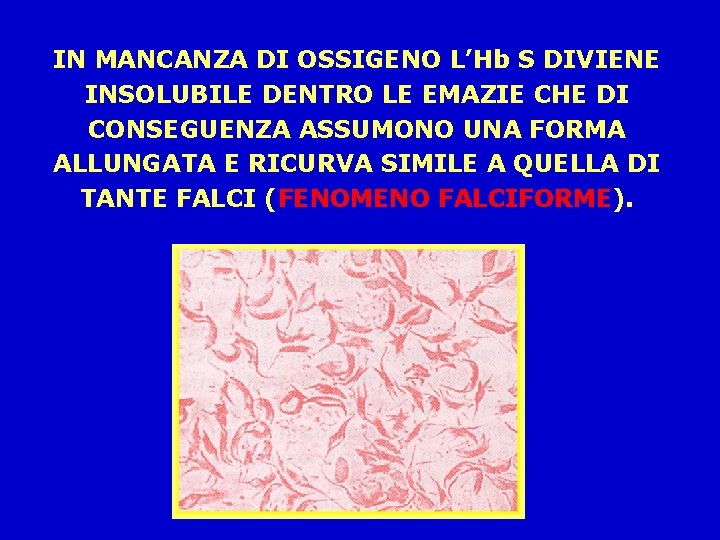 IN MANCANZA DI OSSIGENO L’Hb S DIVIENE INSOLUBILE DENTRO LE EMAZIE CHE DI CONSEGUENZA