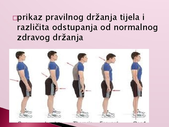 �prikaz pravilnog držanja tijela i različita odstupanja od normalnog zdravog držanja 