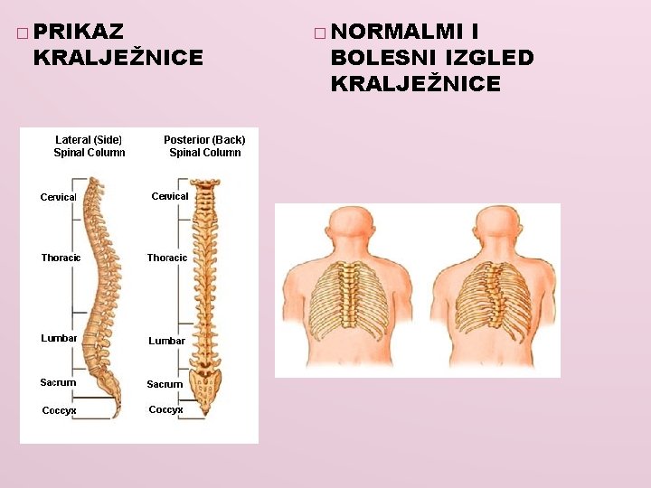 � PRIKAZ KRALJEŽNICE � NORMALMI I BOLESNI IZGLED KRALJEŽNICE 