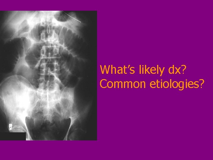 What’s likely dx? Common etiologies? 