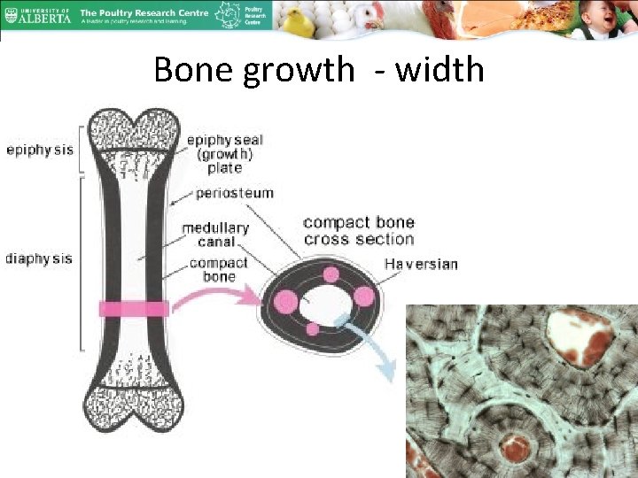 Bone growth - width 