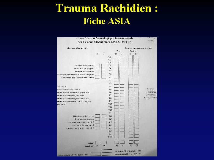 Trauma Rachidien : Fiche ASIA 