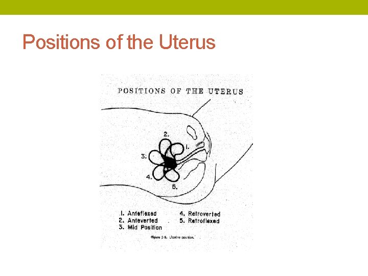 Positions of the Uterus 