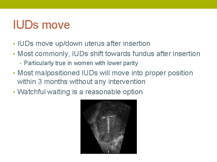IUDs move • IUDs move up/down uterus after insertion • Most commonly, IUDs shift