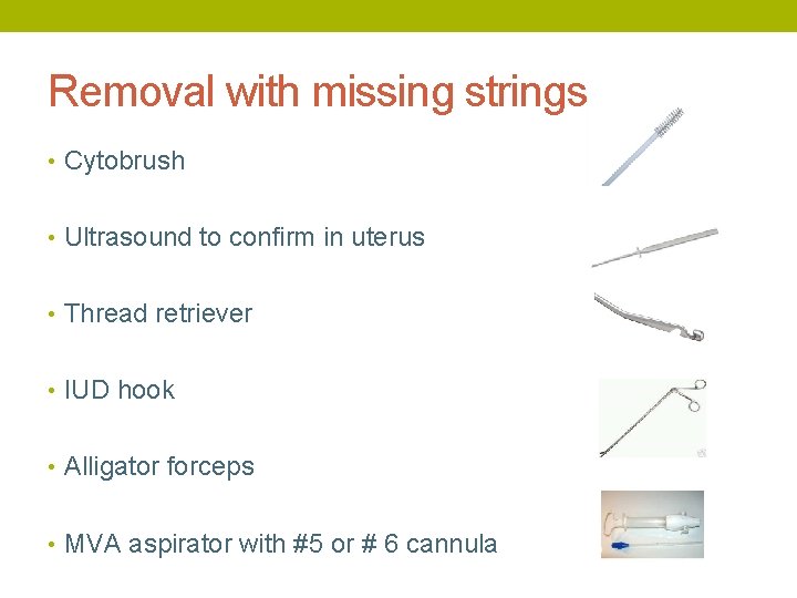 Removal with missing strings • Cytobrush • Ultrasound to confirm in uterus • Thread