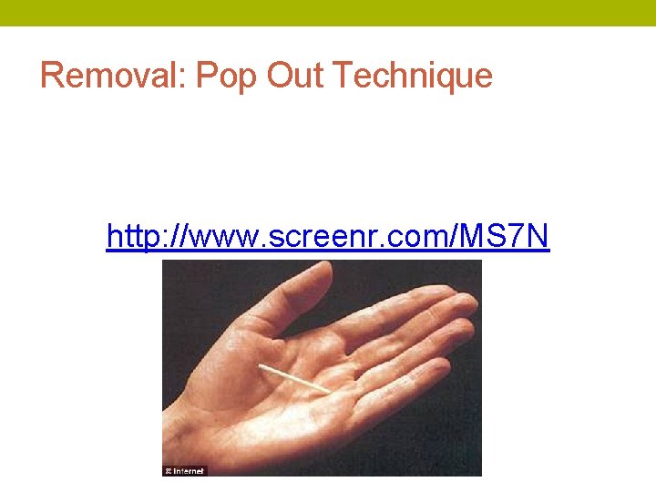 Removal: Pop Out Technique http: //www. screenr. com/MS 7 N 