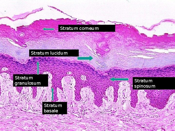 Stratum corneum Stratum lucidum Stratum granulosum Stratum spinosum Stratum basale 