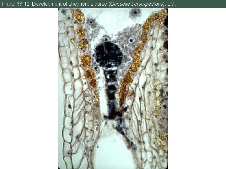 Photo 38. 12 Development of shepherd’s purse (Capsella bursa-pastoris). LM. 