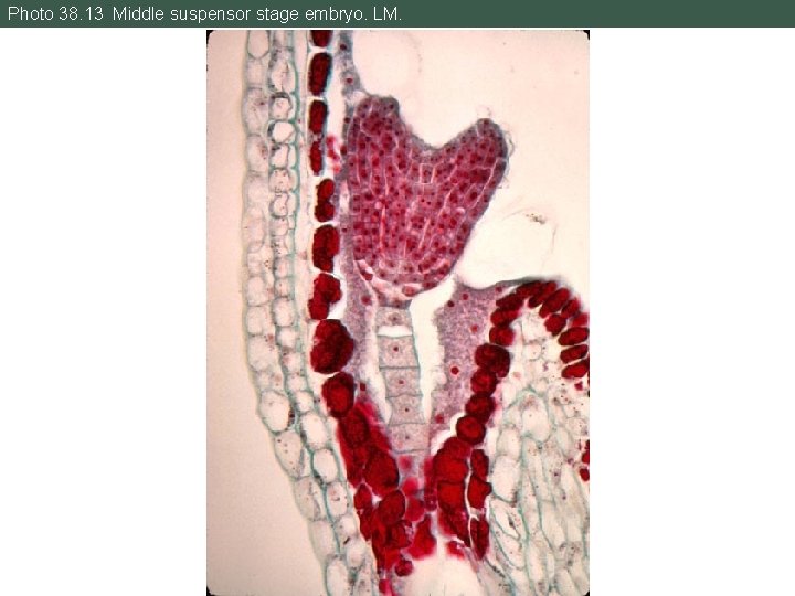 Photo 38. 13 Middle suspensor stage embryo. LM. 