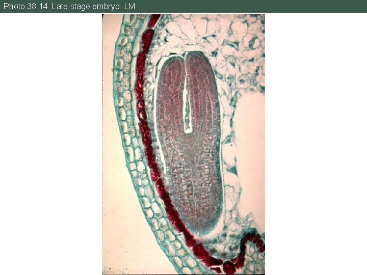 Photo 38. 14 Late stage embryo. LM. 