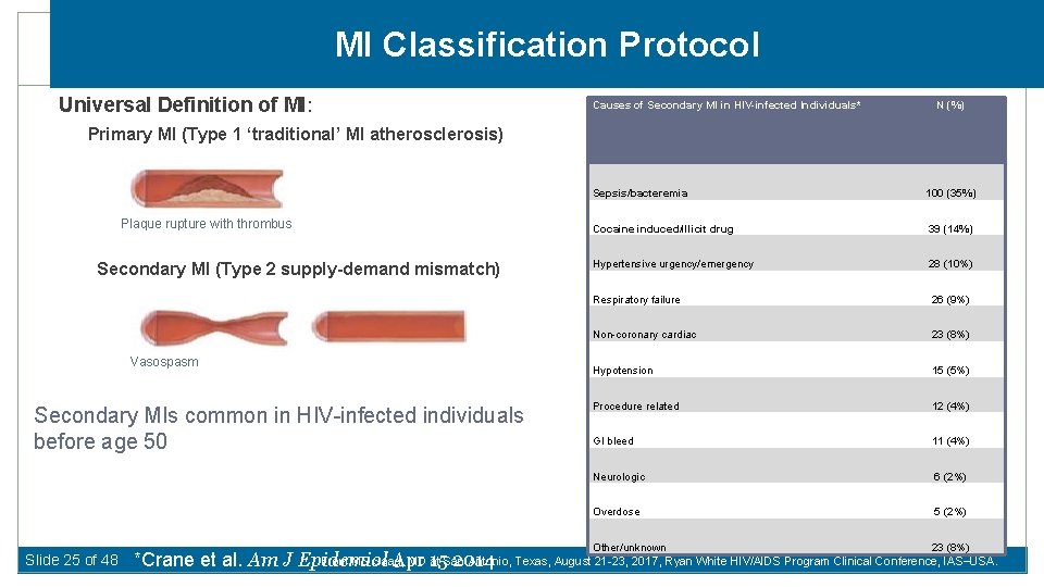 MI Classification Protocol Universal Definition of MI: Causes of Secondary MI in HIV-infected Individuals*