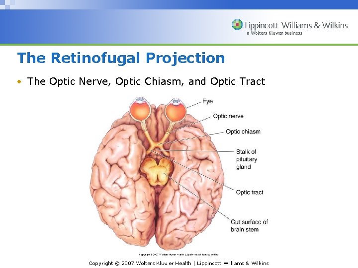 The Retinofugal Projection • The Optic Nerve, Optic Chiasm, and Optic Tract Copyright ©