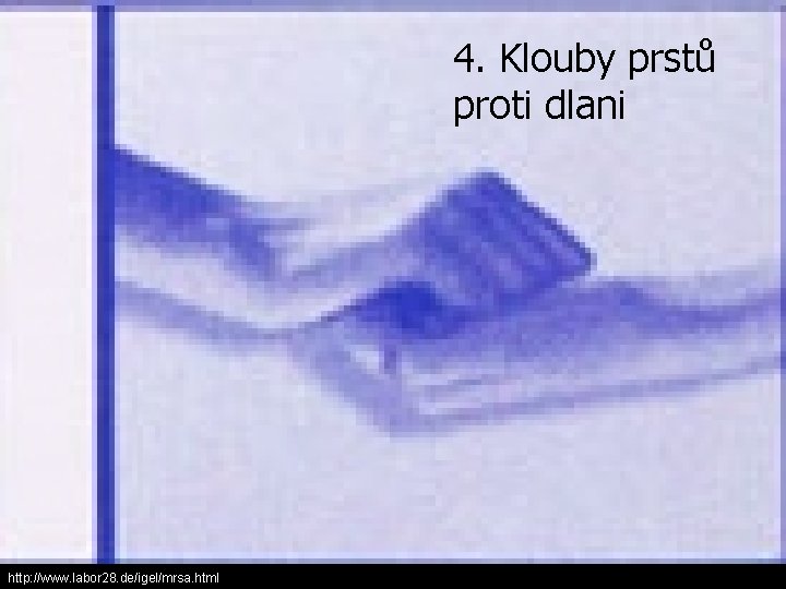4. Klouby prstů proti dlani http: //www. labor 28. de/igel/mrsa. html 