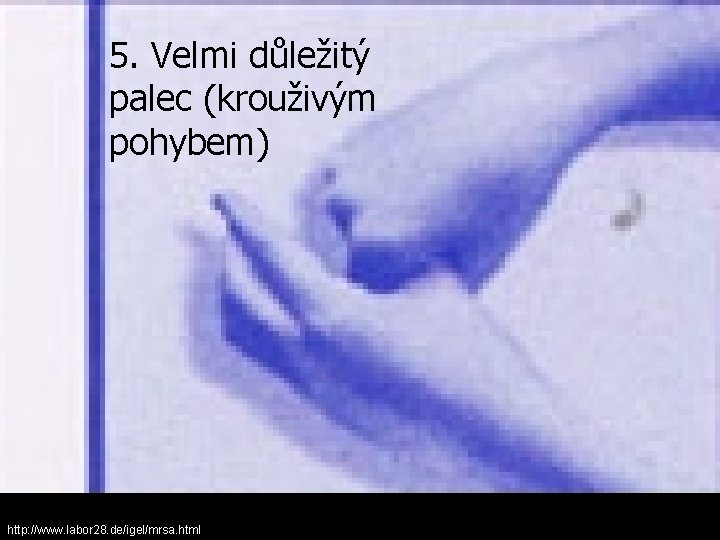 5. Velmi důležitý palec (krouživým pohybem) http: //www. labor 28. de/igel/mrsa. html 