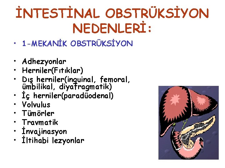 İNTESTİNAL OBSTRÜKSİYON NEDENLERİ: • 1 -MEKANİK OBSTRÜKSİYON • Adhezyonlar • Herniler(Fıtıklar) • Dış herniler(inguinal,