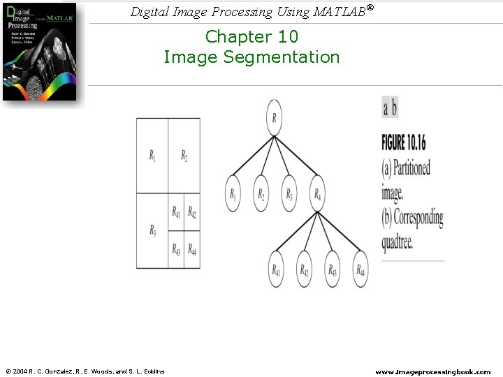 Digital Image Processing Using MATLAB® Chapter 10 Image Segmentation © 2004 R. C. Gonzalez,