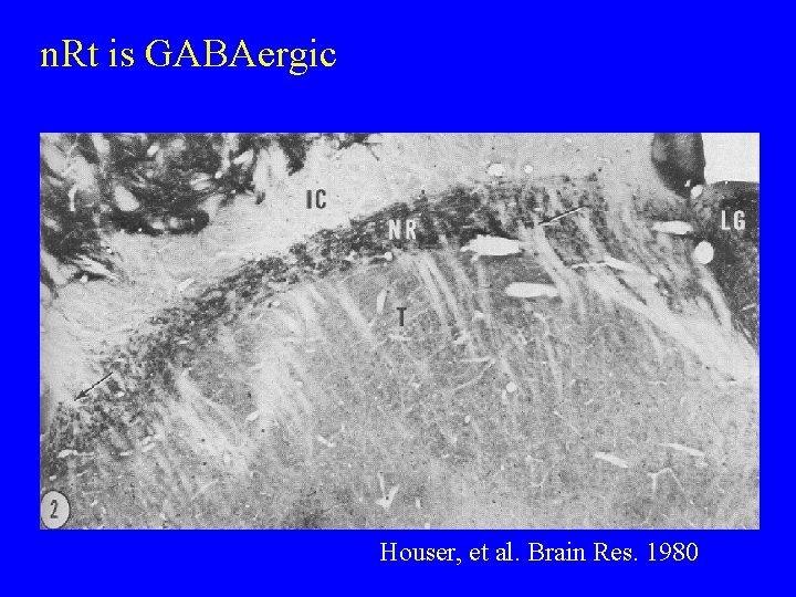 n. Rt is GABAergic Houser, et al. Brain Res. 1980 
