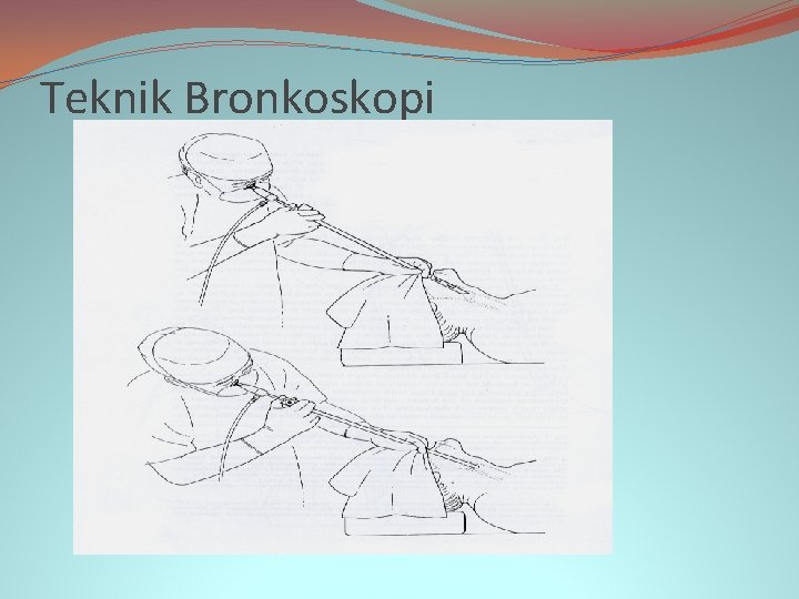 Teknik Bronkoskopi 