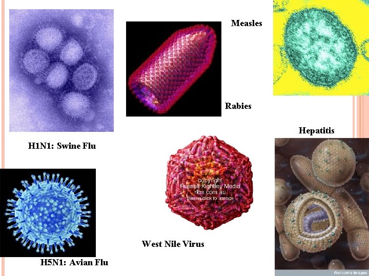 Measles Rabies Hepatitis H 1 N 1: Swine Flu West Nile Virus H 5