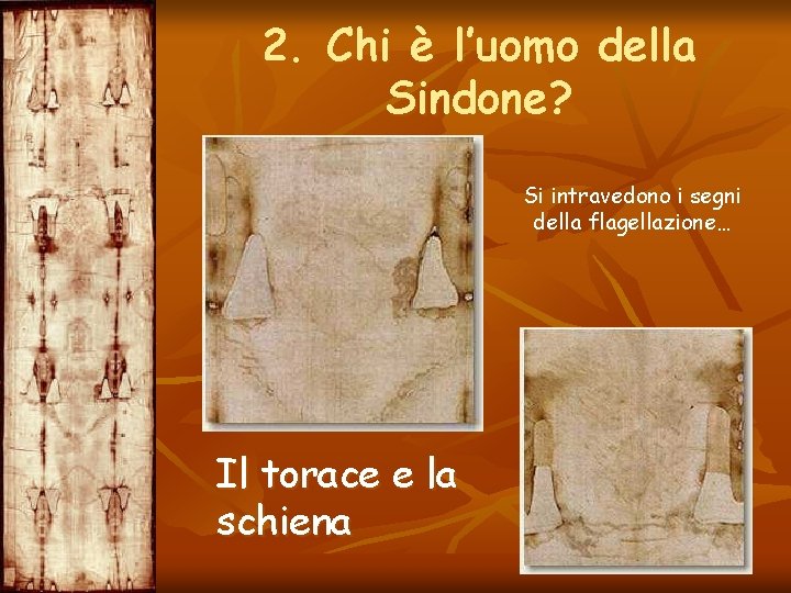 2. Chi è l’uomo della Sindone? Si intravedono i segni della flagellazione… Il torace