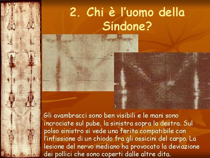 2. Chi è l’uomo della Sindone? Gli avambracci sono ben visibili e le mani