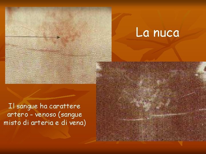 La nuca Il sangue ha carattere artero - venoso (sangue misto di arteria e