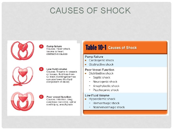 CAUSES OF SHOCK 