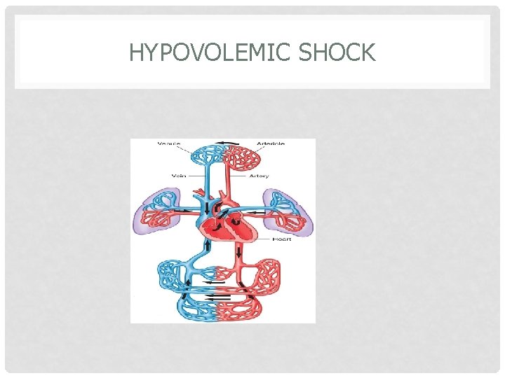 HYPOVOLEMIC SHOCK 