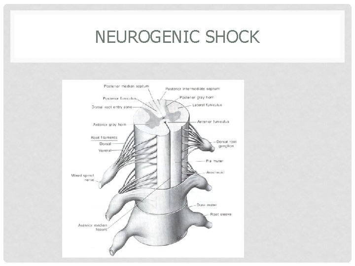 NEUROGENIC SHOCK 