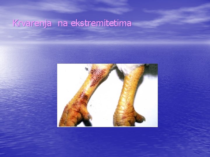 Krvarenja na ekstremitetima 