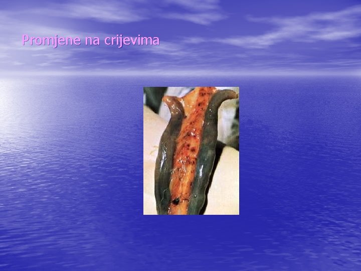 Promjene na crijevima 