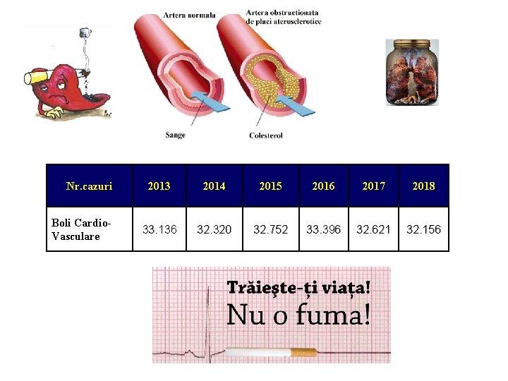 Nr. cazuri Boli Cardio. Vasculare 2013 2014 2015 2016 2017 2018 33. 136 32.