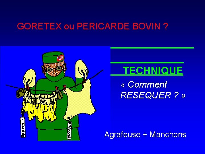 GORETEX ou PERICARDE BOVIN ? TECHNIQUE « Comment RESEQUER ? » Agrafeuse + Manchons