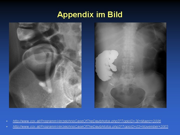 Appendix im Bild • http: //www. cox. at/Programm. Verzeichnis. Case. Of. The. Day/photos. php