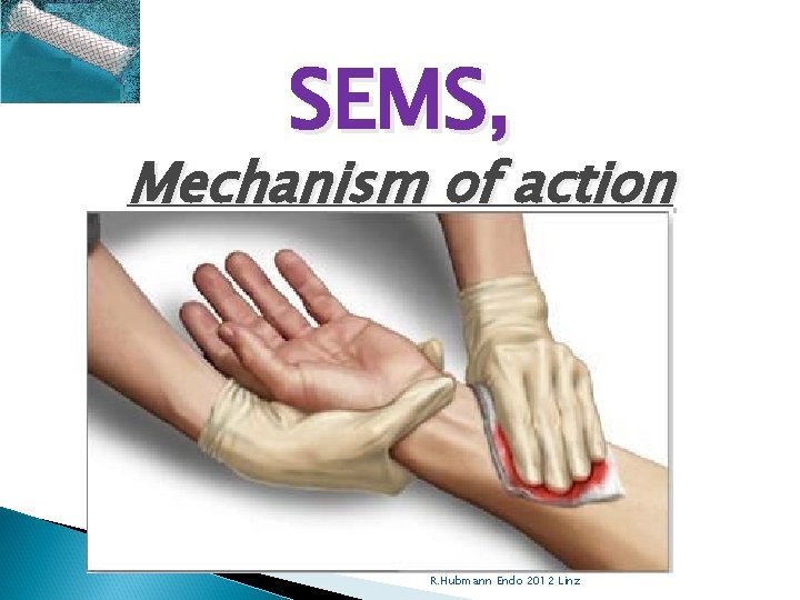 SEMS, Mechanism of action R. Hubmann Endo 2012 Linz 