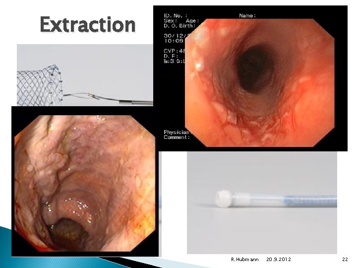 Extraction R. Hubmann 20. 9. 2012 22 