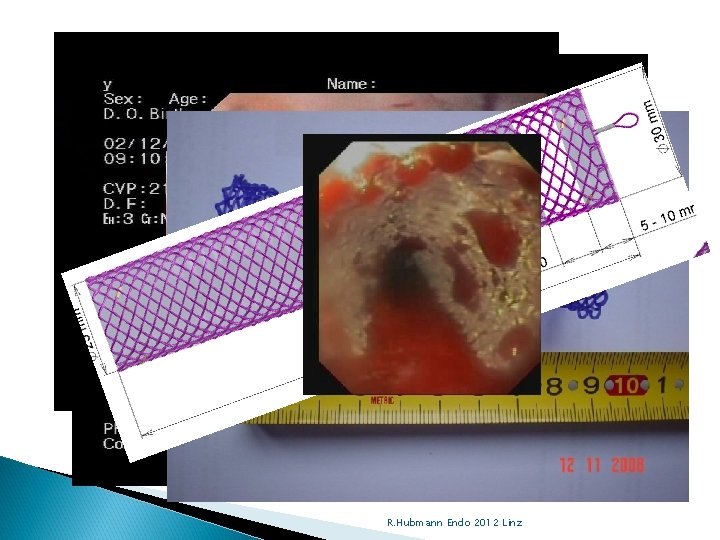 R. Hubmann Endo 2012 Linz 